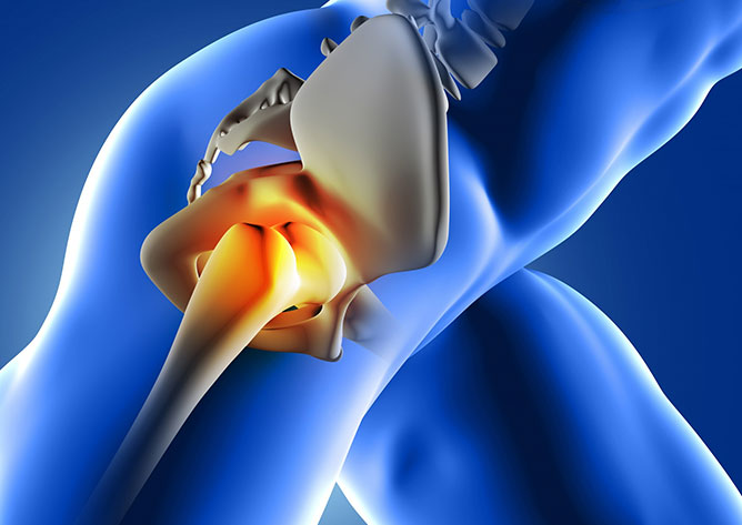 Knee-Replacement-Surgery-S