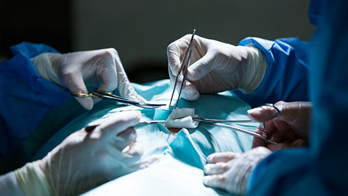 General-Surgery
